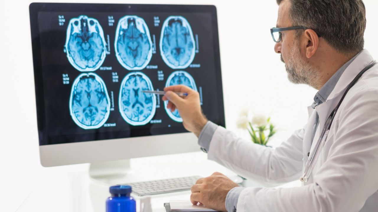Médico analisando raio-x do cérebro de paciente